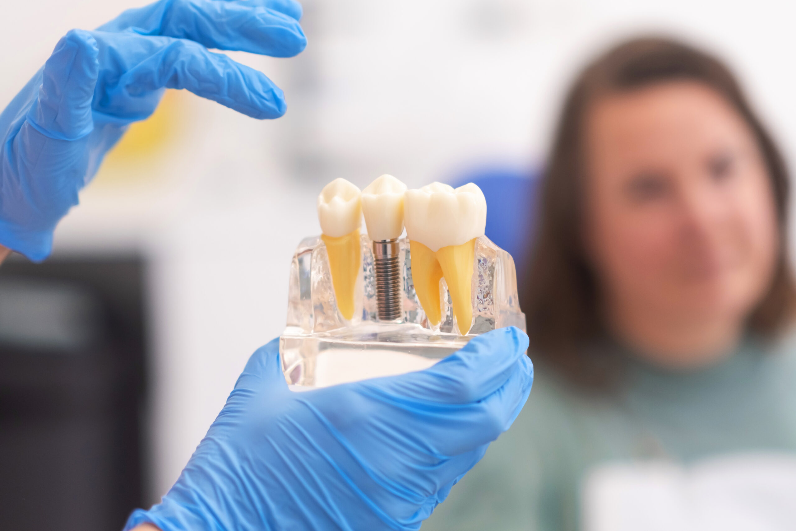 Dental Implants – A viable option for tooth replacement