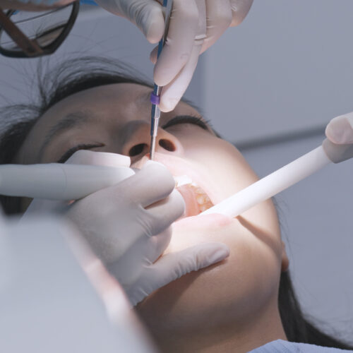 Woman undergo professional tooth whitening and ultrasound cleaning at dental clinic