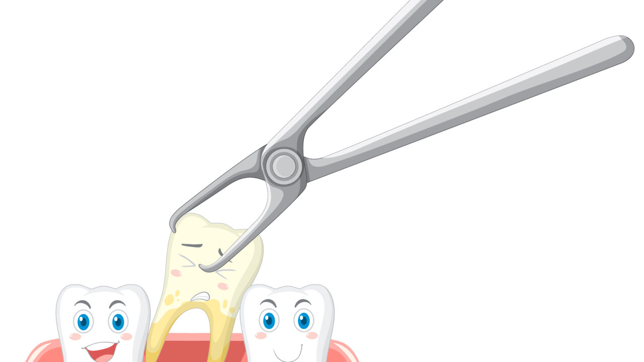 What to do after a tooth extraction?