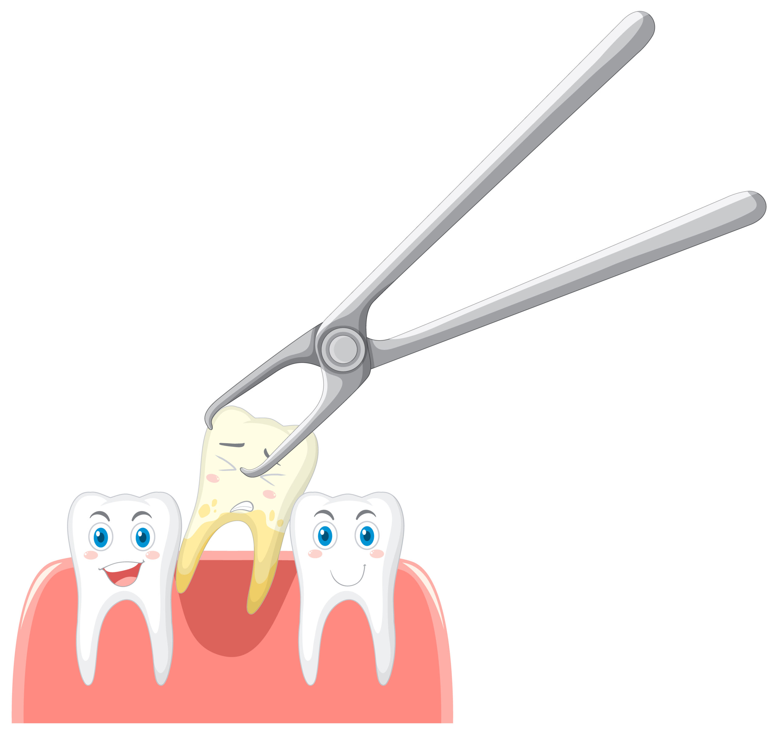 What to do after a tooth extraction?